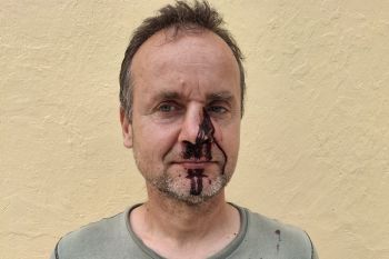 Five committee members injured by hunters in Greece